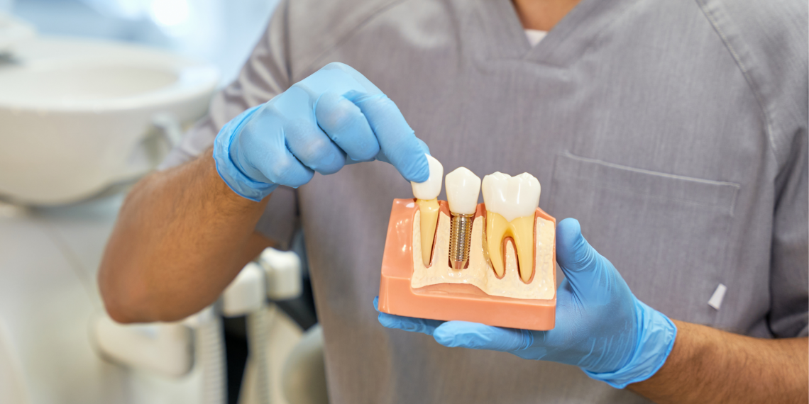 Clínica Dental Saúde | Faça seu implante dentário parcelado em até 15 vezes 🦷