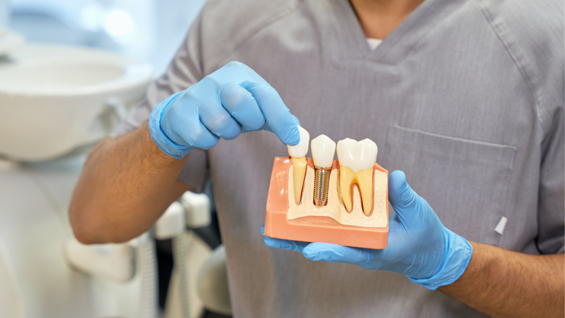 Clínica Dental Saúde | Faça seu implante dentário parcelado em até 15 vezes 🦷