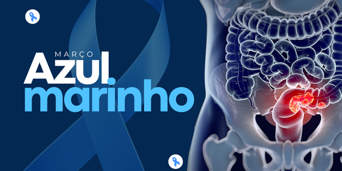 Março Azul-Marinho esclarece sobre prevenção e tratamento para o câncer colorretal
