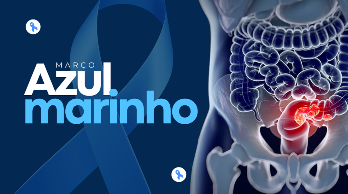 Março Azul-Marinho esclarece sobre prevenção e tratamento para o câncer colorretal